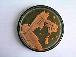 Rhodococcus spec.